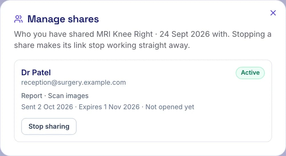 The Manage shares window, listing a share with a GP and a Stop sharing button