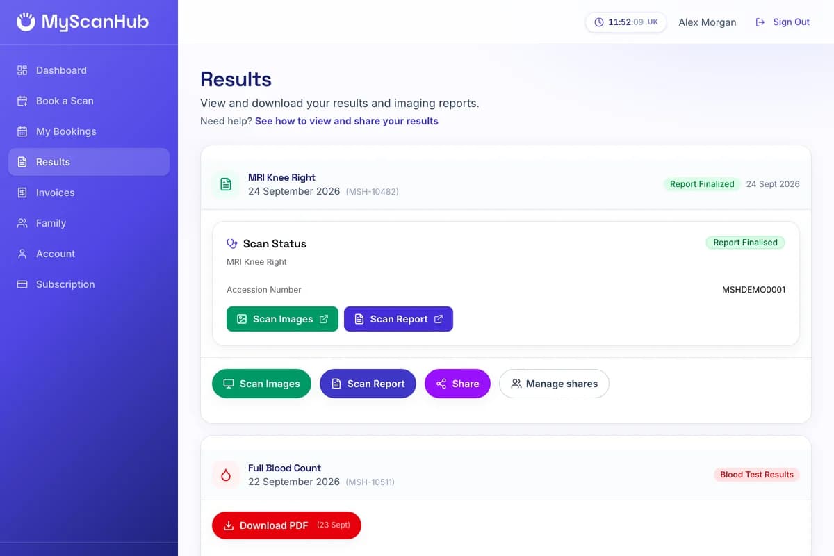 The Results page, showing an MRI with Scan Images, Scan Report, Share and Manage shares buttons, and a blood test with a Download PDF button