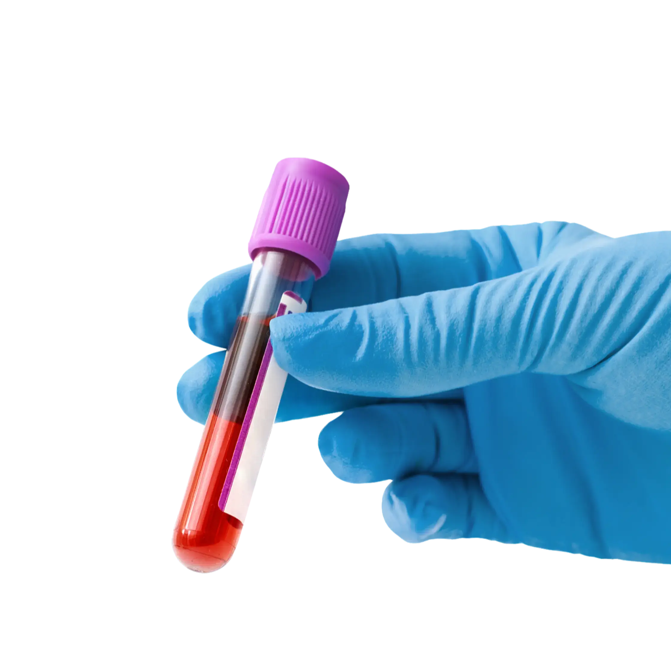Blood Tests